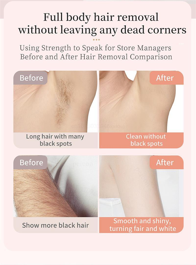 Depilador Facial femenina